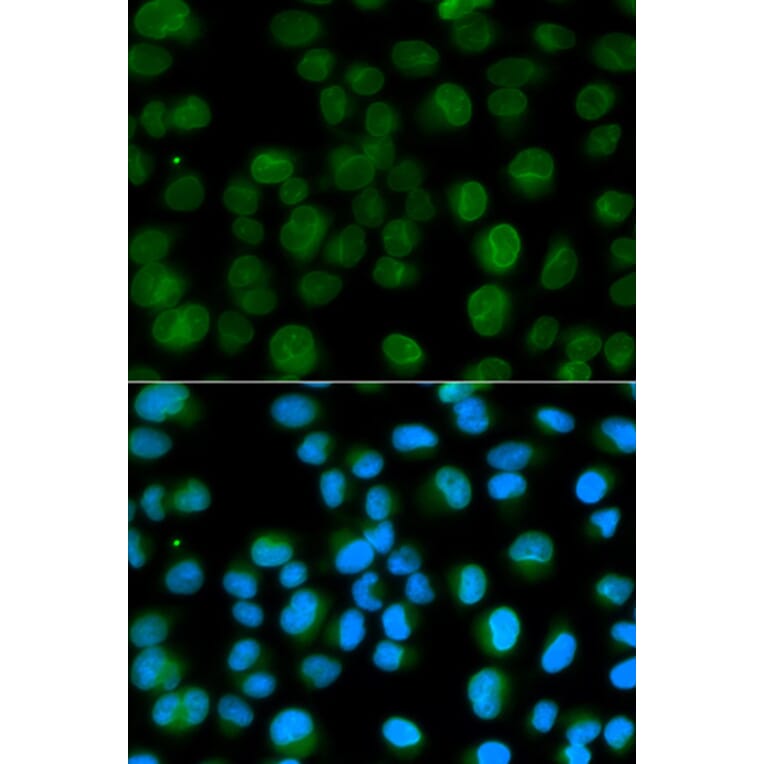Anti-EMD Antibody from Bioworld Technology (BS6162) - Antibodies.com