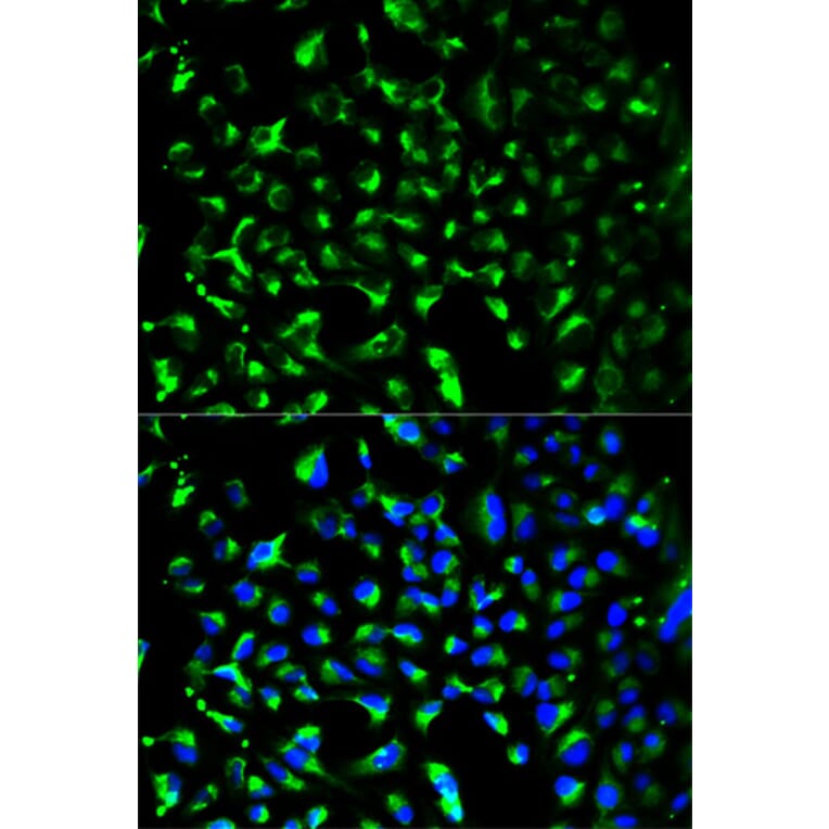 Anti-PHB Antibody from Bioworld Technology (BS6163) - Antibodies.com