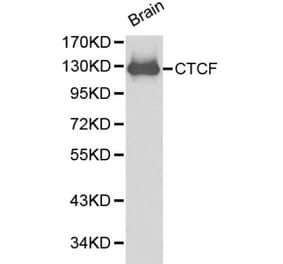 Anti-CTCF Antibody from Bioworld Technology (BS6164) - Antibodies.com