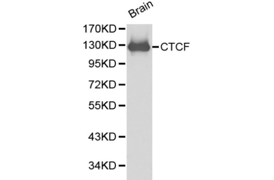 Anti-CTCF Antibody from Bioworld Technology (BS6164) - Antibodies.com