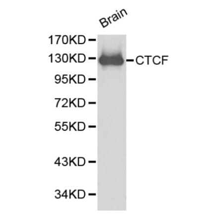 Anti-CTCF Antibody from Bioworld Technology (BS6164) - Antibodies.com