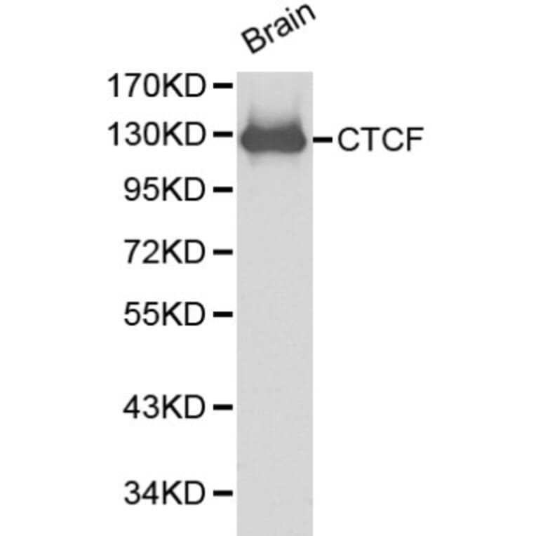 Anti-CTCF Antibody from Bioworld Technology (BS6164) - Antibodies.com