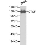 Anti-CTCF Antibody from Bioworld Technology (BS6164) - Antibodies.com