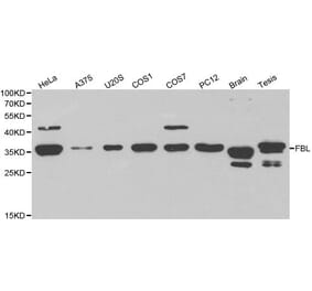 Anti-FBL Antibody from Bioworld Technology (BS6167) - Antibodies.com