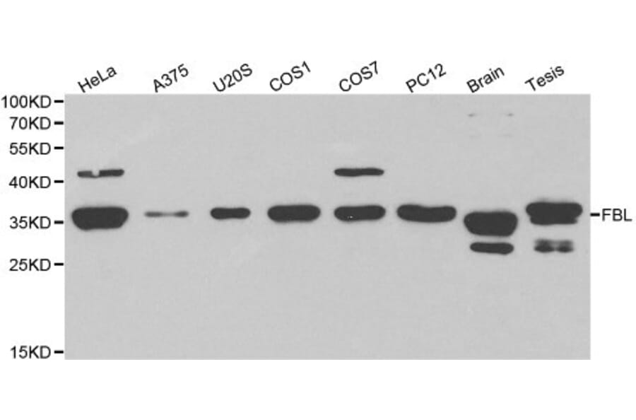Anti-FBL Antibody from Bioworld Technology (BS6167) - Antibodies.com
