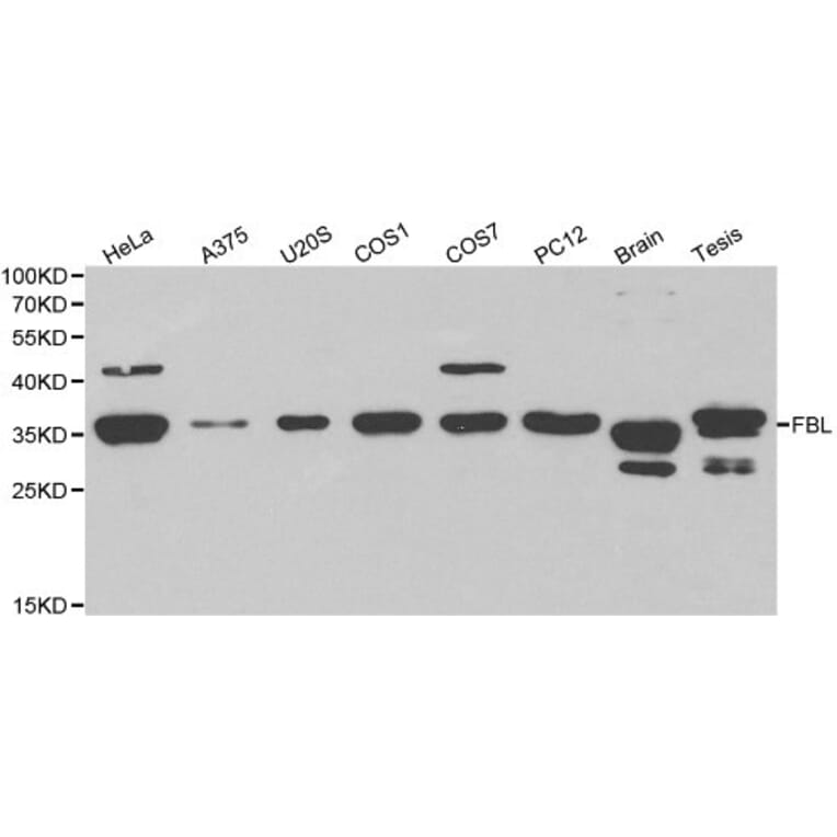 Anti-FBL Antibody from Bioworld Technology (BS6167) - Antibodies.com