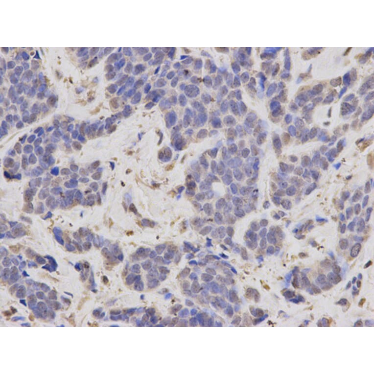 Anti-FBL Antibody from Bioworld Technology (BS6167) - Antibodies.com