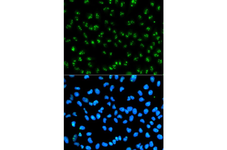 Anti-FBL Antibody from Bioworld Technology (BS6167) - Antibodies.com