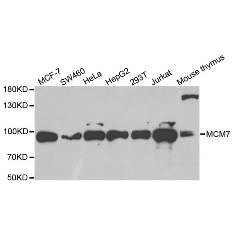 Anti-MCM7 Antibody from Bioworld Technology (BS6169) - Antibodies.com