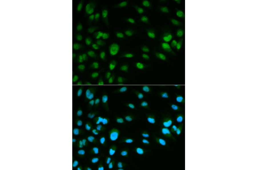 Anti-MCM7 Antibody from Bioworld Technology (BS6169) - Antibodies.com