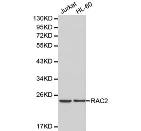 Anti-RAC2 Antibody from Bioworld Technology (BS6170) - Antibodies.com