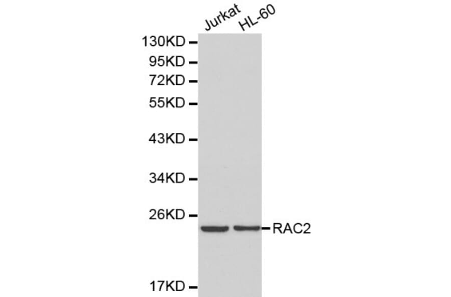 Anti-RAC2 Antibody from Bioworld Technology (BS6170) - Antibodies.com