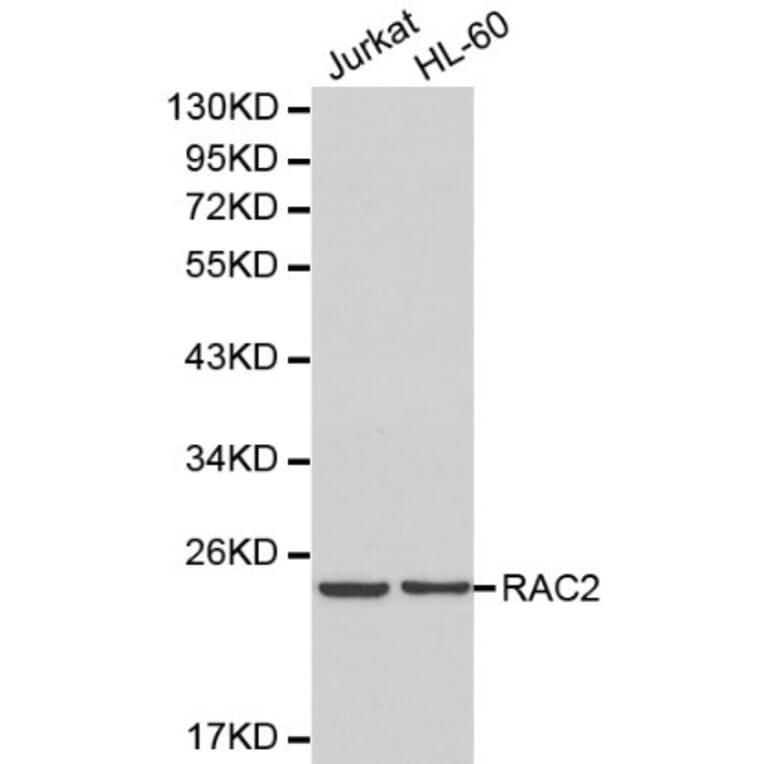 Anti-RAC2 Antibody from Bioworld Technology (BS6170) - Antibodies.com