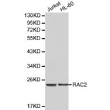 Anti-RAC2 Antibody from Bioworld Technology (BS6170) - Antibodies.com