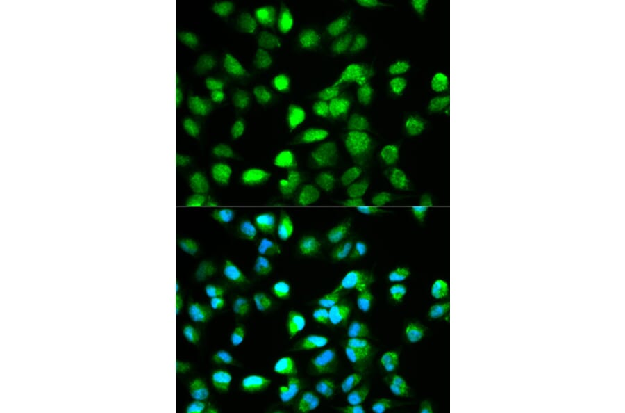 Anti-TCF4 Antibody from Bioworld Technology (BS6172) - Antibodies.com