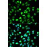 Anti-TCF4 Antibody from Bioworld Technology (BS6172) - Antibodies.com