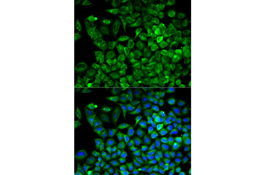 Anti-Aldolase A Antibody from Bioworld Technology (BS6173) - Antibodies.com