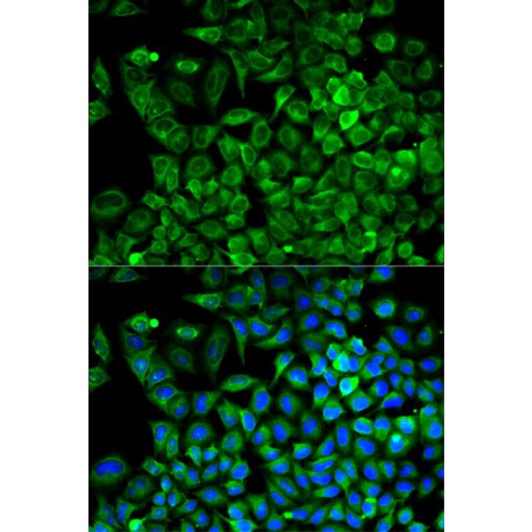 Anti-Aldolase A Antibody from Bioworld Technology (BS6173) - Antibodies.com