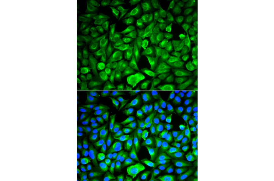 Anti-PEBP1 Antibody from Bioworld Technology (BS6176) - Antibodies.com