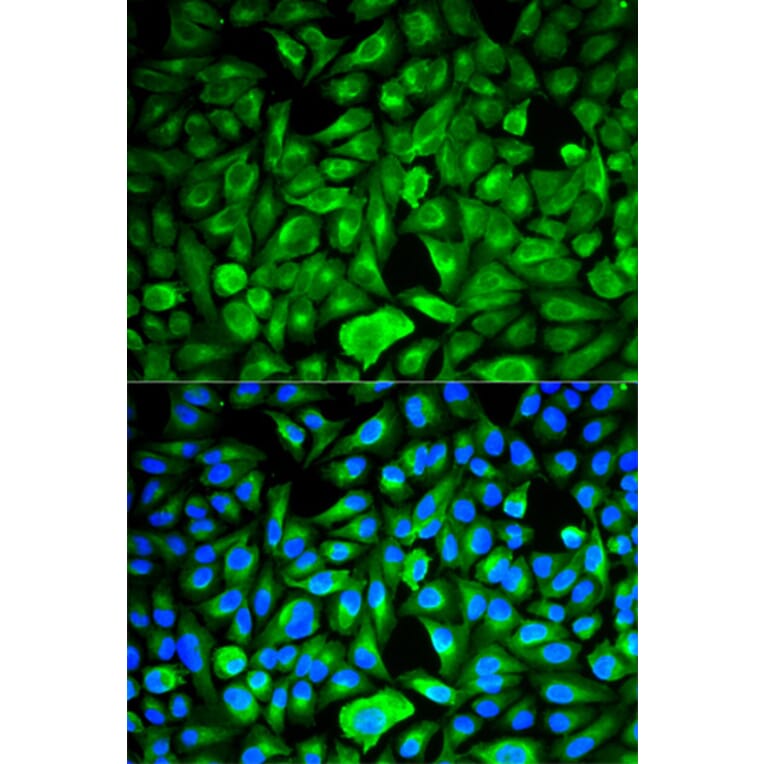 Anti-PEBP1 Antibody from Bioworld Technology (BS6176) - Antibodies.com