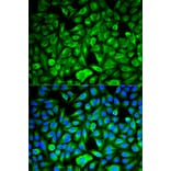 Anti-PEBP1 Antibody from Bioworld Technology (BS6176) - Antibodies.com