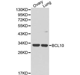 Anti-Bcl-10 Antibody from Bioworld Technology (BS6177) - Antibodies.com