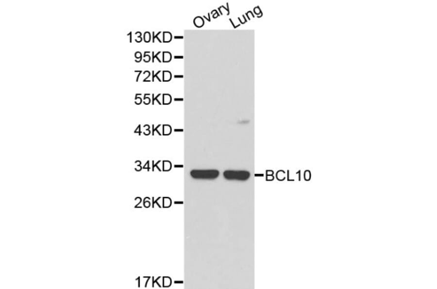 Anti-Bcl-10 Antibody from Bioworld Technology (BS6177) - Antibodies.com