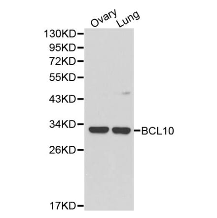 Anti-Bcl-10 Antibody from Bioworld Technology (BS6177) - Antibodies.com
