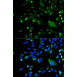 Anti-Bcl-10 Antibody from Bioworld Technology (BS6177) - Antibodies.com