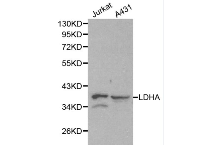 Anti-LDHA Antibody from Bioworld Technology (BS6179) - Antibodies.com