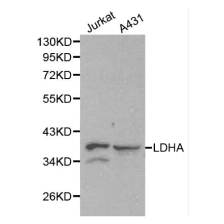 Anti-LDHA Antibody from Bioworld Technology (BS6179) - Antibodies.com