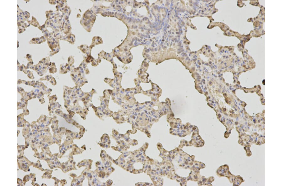 Anti-LDHA Antibody from Bioworld Technology (BS6179) - Antibodies.com