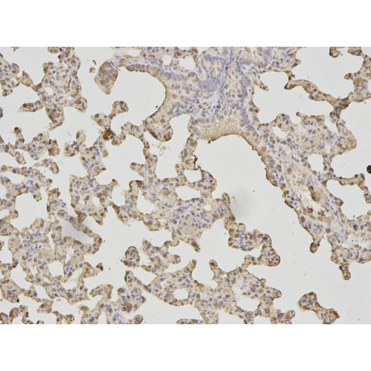 Anti-LDHA Antibody from Bioworld Technology (BS6179) - Antibodies.com