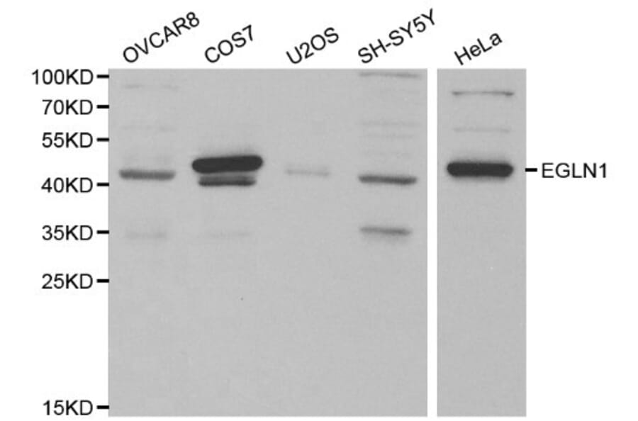 Anti-EGLN1 Antibody from Bioworld Technology (BS6184) - Antibodies.com