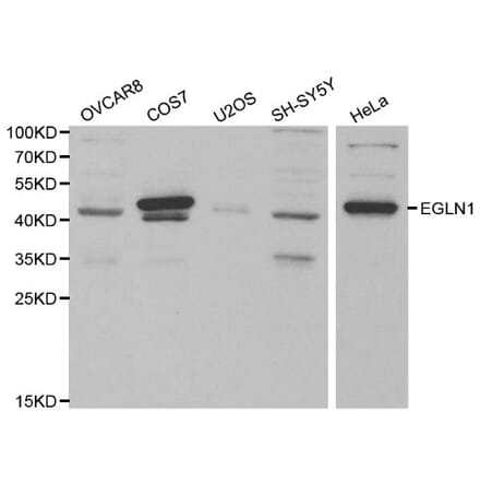 Anti-EGLN1 Antibody from Bioworld Technology (BS6184) - Antibodies.com