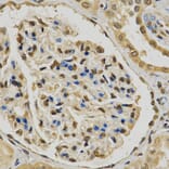 Anti-EGLN1 Antibody from Bioworld Technology (BS6184) - Antibodies.com
