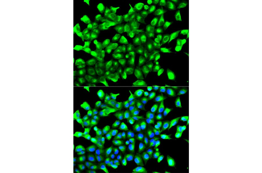 Anti-EGLN1 Antibody from Bioworld Technology (BS6184) - Antibodies.com