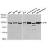 Anti-RRM1 Antibody from Bioworld Technology (BS6185) - Antibodies.com