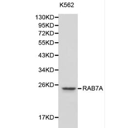 Anti-RAB7A Antibody from Bioworld Technology (BS6187) - Antibodies.com