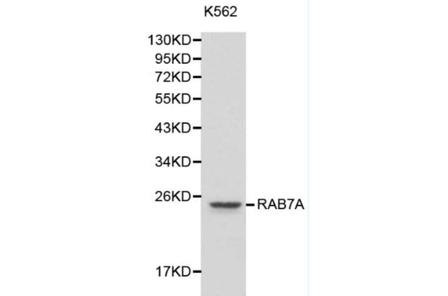 Anti-RAB7A Antibody from Bioworld Technology (BS6187) - Antibodies.com