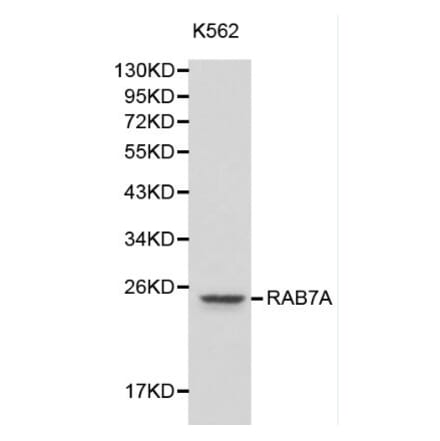 Anti-RAB7A Antibody from Bioworld Technology (BS6187) - Antibodies.com