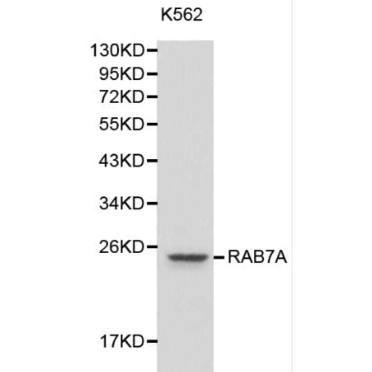 Anti-RAB7A Antibody from Bioworld Technology (BS6187) - Antibodies.com