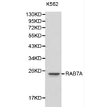 Anti-RAB7A Antibody from Bioworld Technology (BS6187) - Antibodies.com