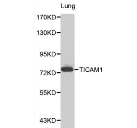 Anti-TICAM1 Antibody from Bioworld Technology (BS6188) - Antibodies.com