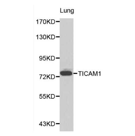 Anti-TICAM1 Antibody from Bioworld Technology (BS6188) - Antibodies.com