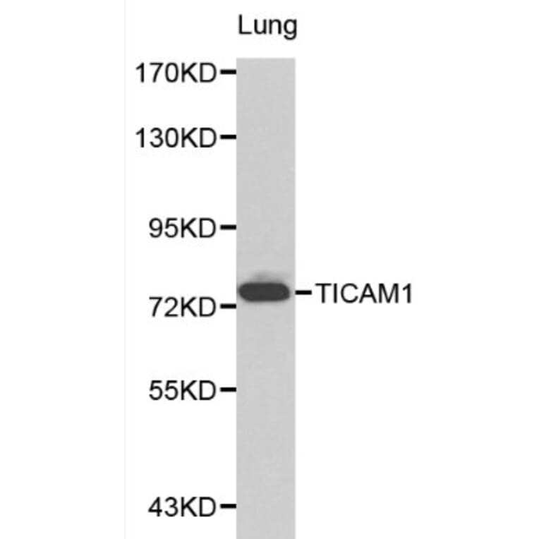Anti-TICAM1 Antibody from Bioworld Technology (BS6188) - Antibodies.com