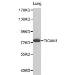 Anti-TICAM1 Antibody from Bioworld Technology (BS6188) - Antibodies.com