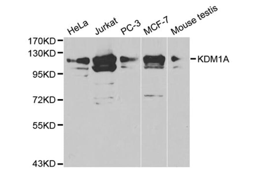 Anti-KDM1A Antibody from Bioworld Technology (BS6189) - Antibodies.com