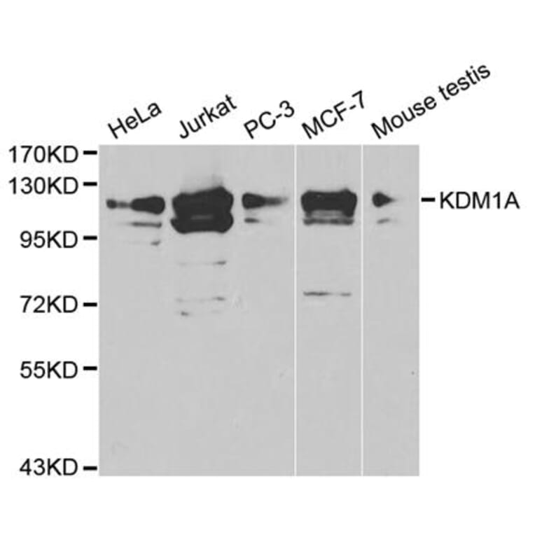 Anti-KDM1A Antibody from Bioworld Technology (BS6189) - Antibodies.com
