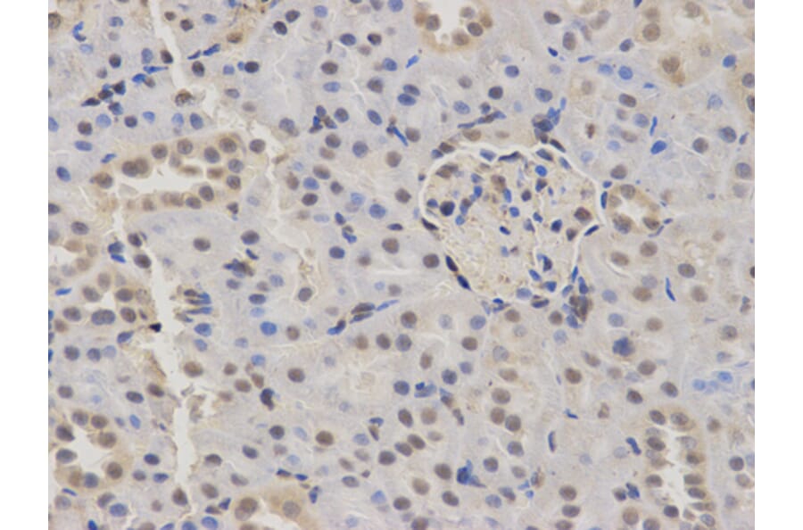 Anti-KDM1A Antibody from Bioworld Technology (BS6189) - Antibodies.com